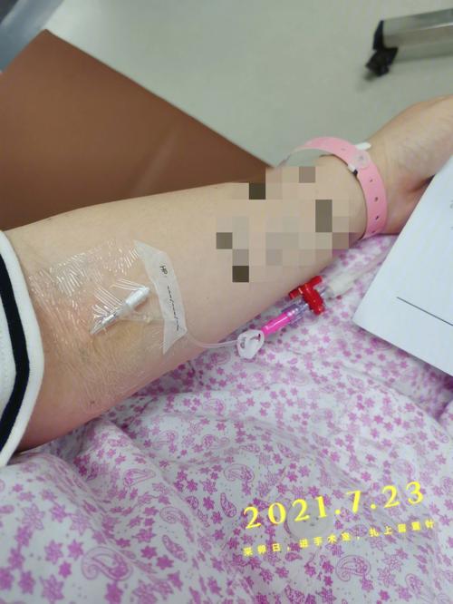 试管代怀打什么吊针_试管代怀打什么吊针:解密试管代孕中的关键环节